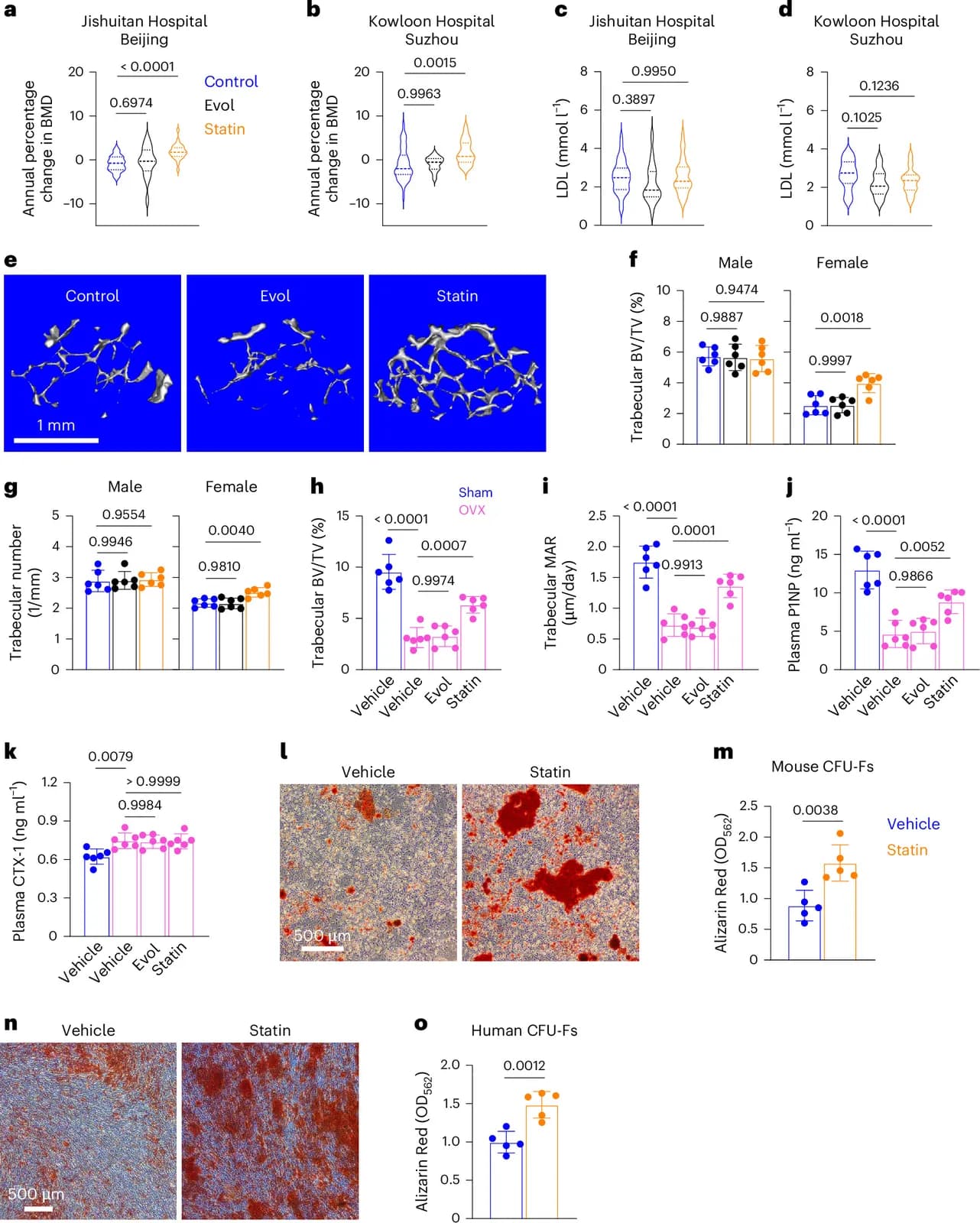 Statins promote bone anabolism in estrogen deficiency by inducing osteogenic differentiation of skeletal stem/progenitor cells (Nature Aging)