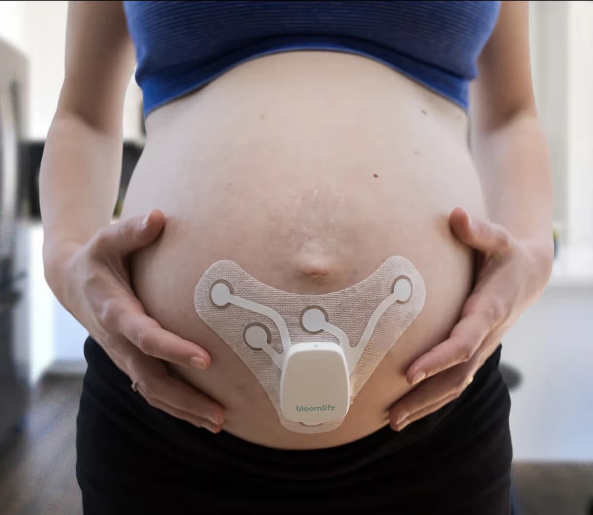 Bloomlife Bloomlife Smart Pregnancy Tracker — official product image 1