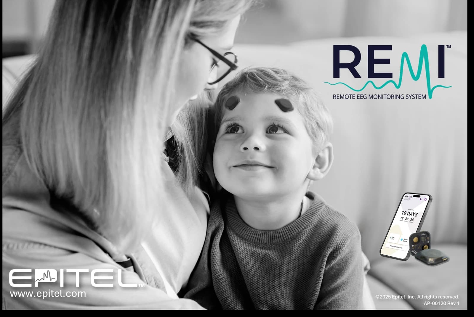 Epitel REMI Remote EEG Monitoring System — official product image 1