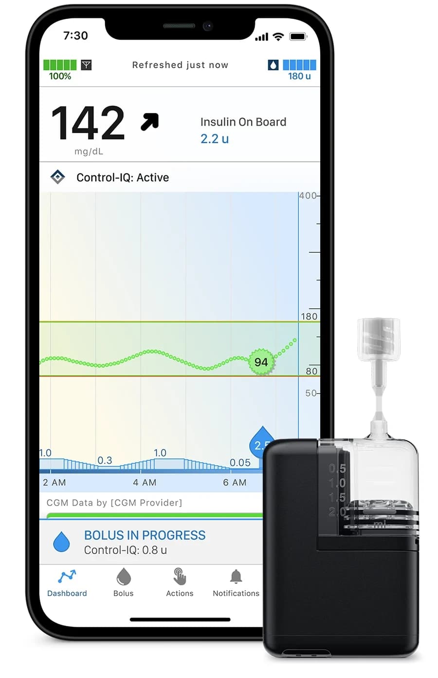 Tandem Diabetes Care Tandem Mobi — official product image 1