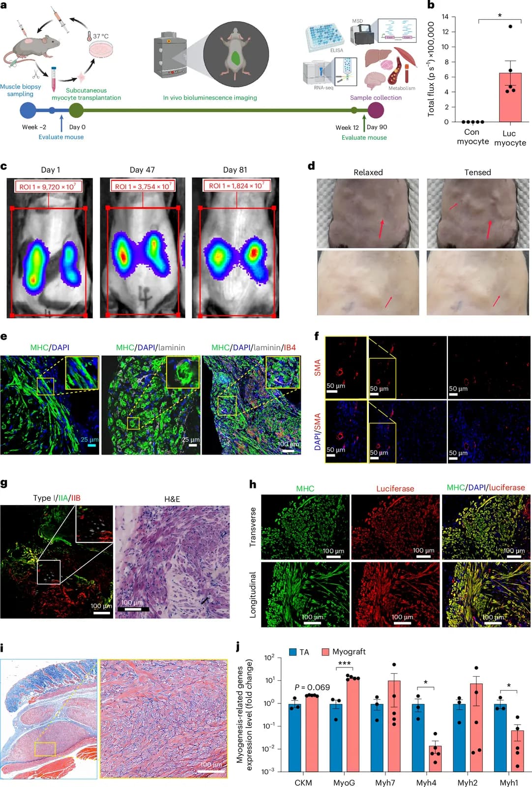 Contractile myografts confer systemic anti-aging benefits (Nature - Biotechnology)