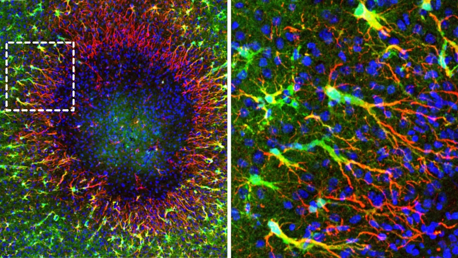 The adult brain can repair itself better than scientists thought