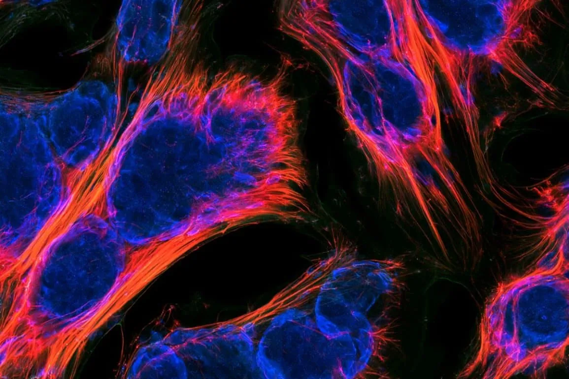 TRF2 Preserves Muscle Stem Cell Identity and Drive Repair
