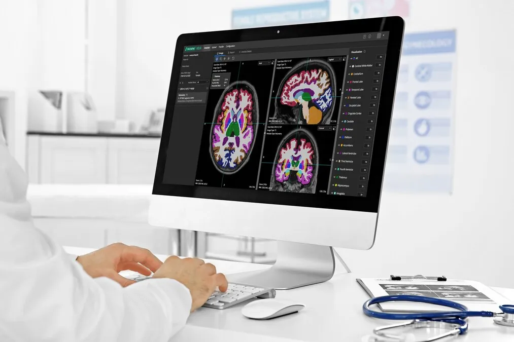 Neurophet Supplies