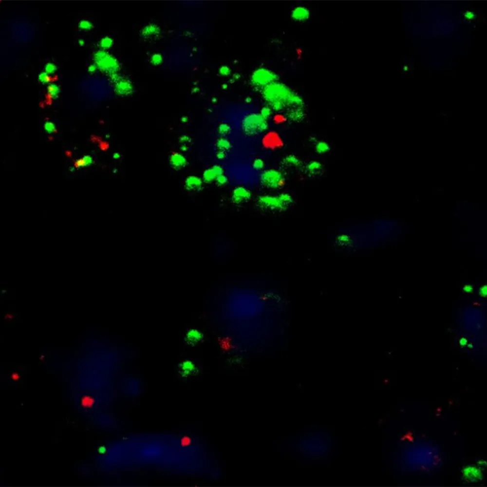 Brain signaling mechanism may explain clozapine weight gain: Newsroom - UT Southwestern, Dallas, Texas