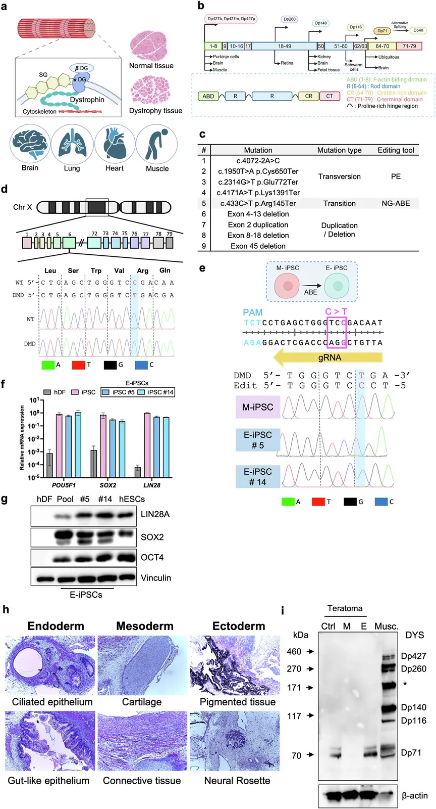 Patient-derived teratomas as a humanized platform for dystrophin restoration by ex vivo cell therapy and in vivo base editing