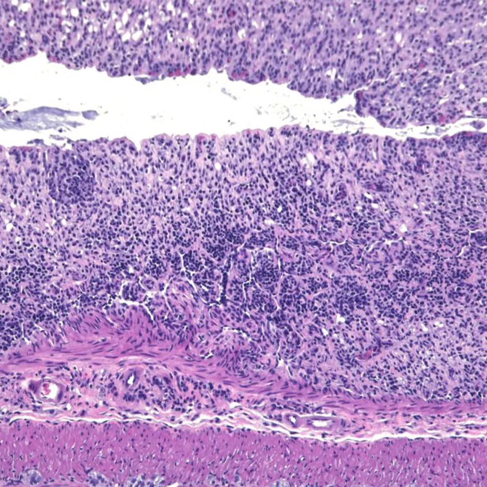 Protein puts brakes on intestinal inflammation, UTSW study finds: Newsroom - UT Southwestern, Dallas, Texas
