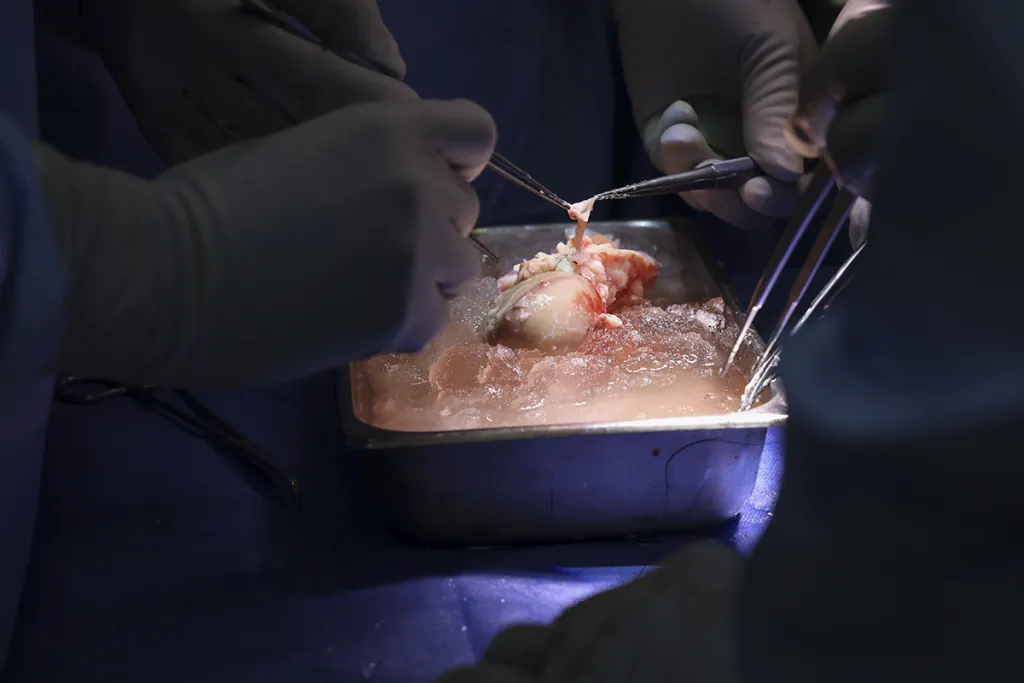 Pig kidneys just bought humans extra years in eGenesis study