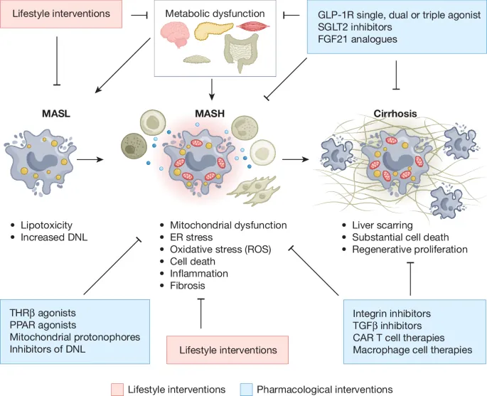 Current therapeutic landscape and future treatment perspectives of MASH - Nature