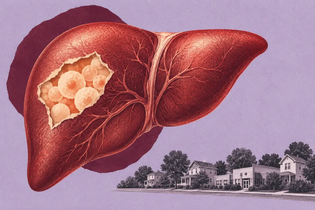 Cell therapy for liver failure eyes hometown access