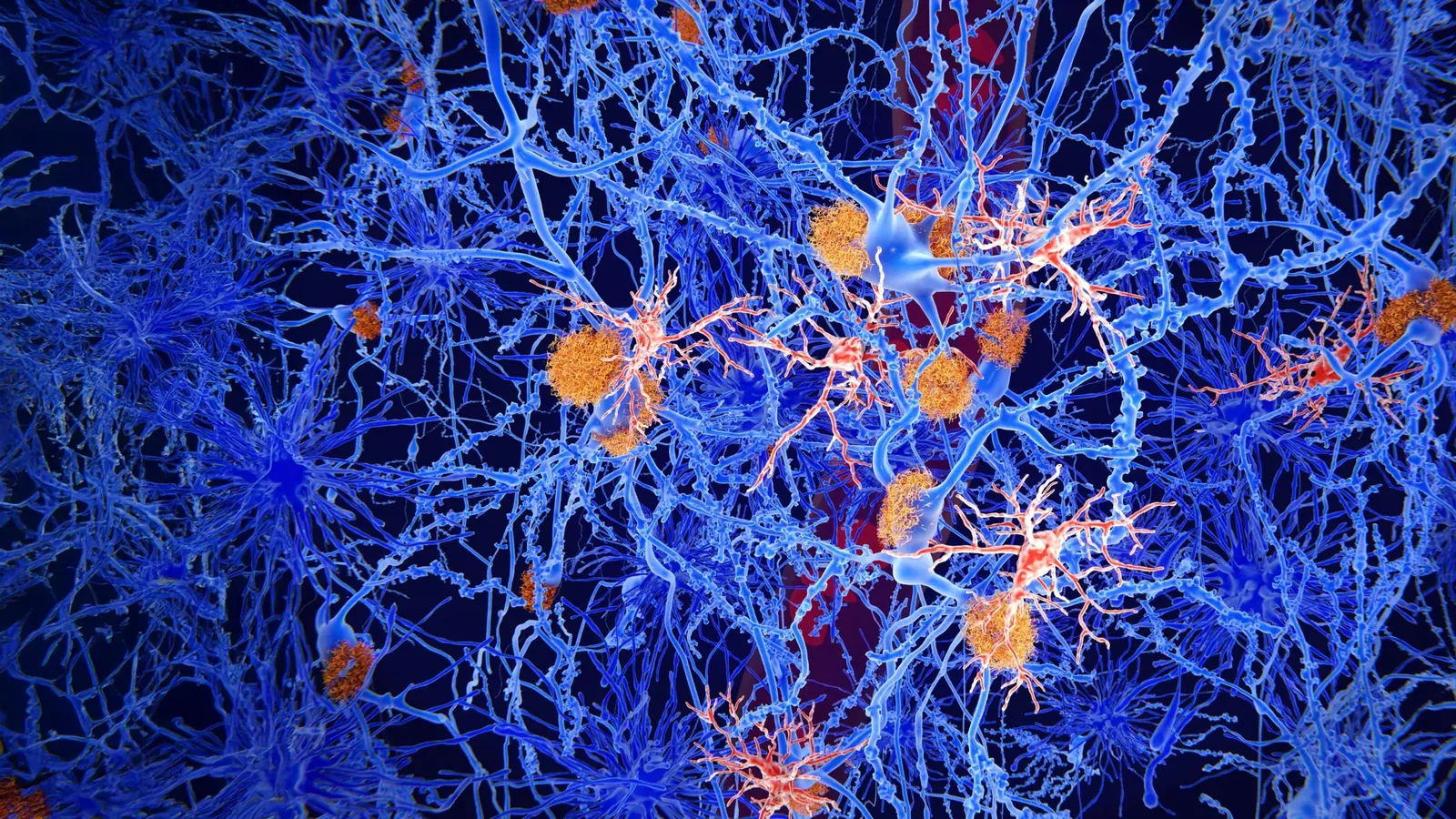 Scientists reprogram brain immune cells to fight Alzheimer’s (Science Daily - Health & Medicine)