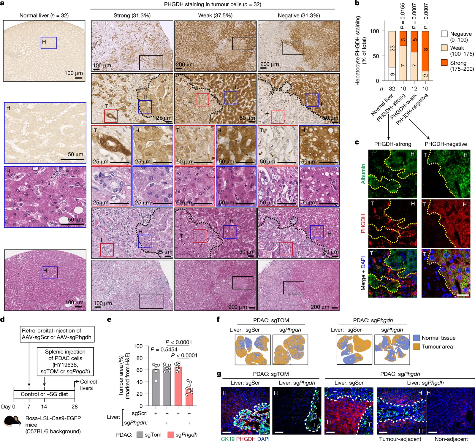 Hepatocytes promote liver metastasis of pancreatic cancer by providing serine