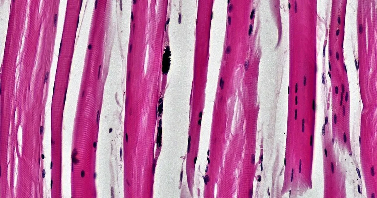 Cardiolipin loss drives the muscle shift of aging in mice