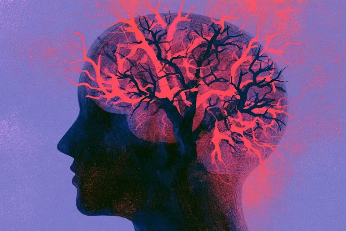 PCOS/PMOS Increases Alzheimer’s Risk