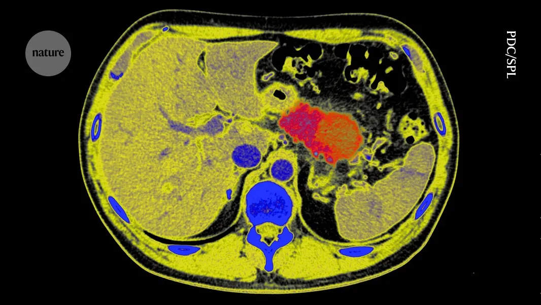 Can pancreatic cancer be stopped in its tracks? Radical tactic raises hopes