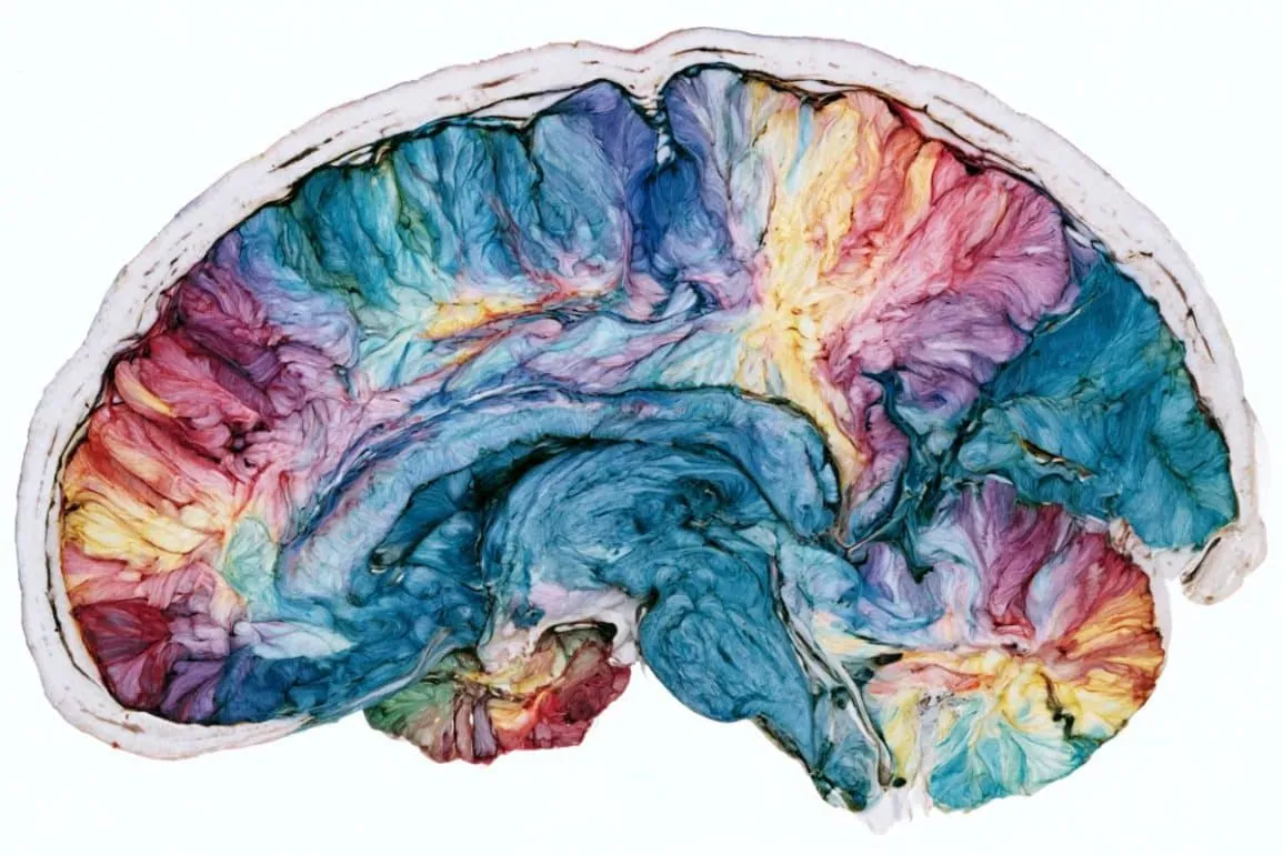 Brain Tissue Patterns and Genetics Drive MS Progression