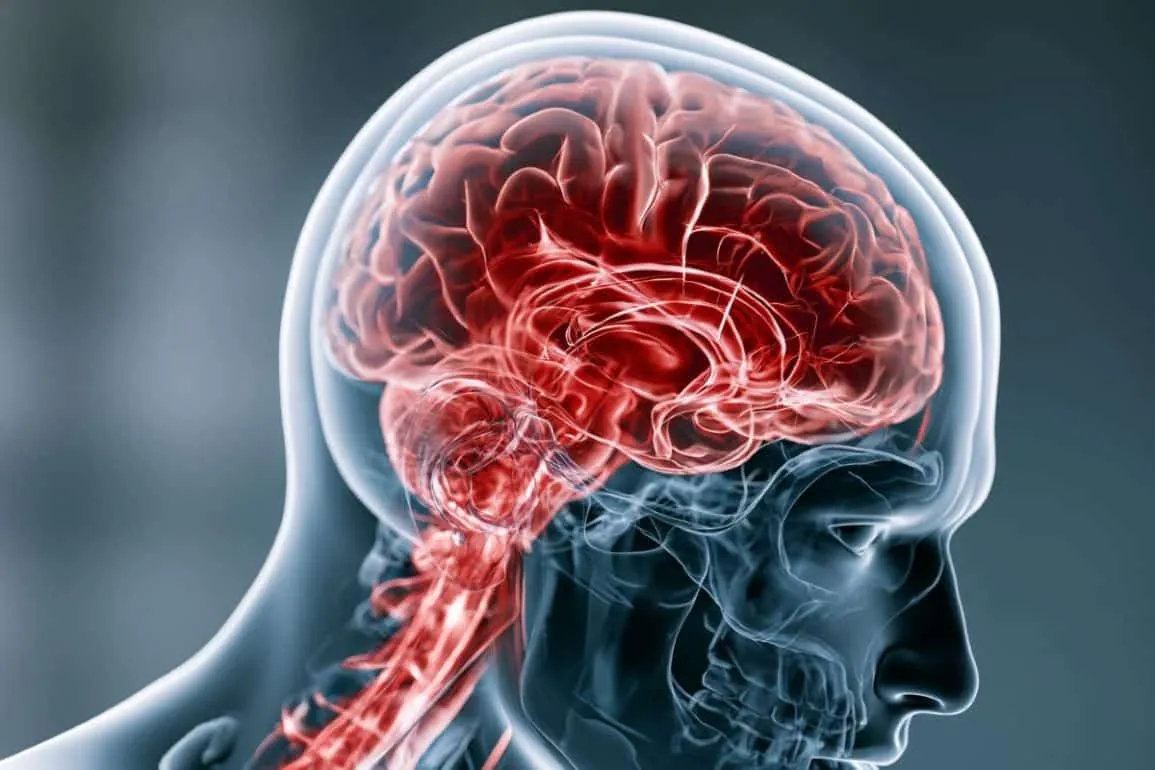 TBI and Common Neurological Conditions Accelerate One Another (Neuroscience News)