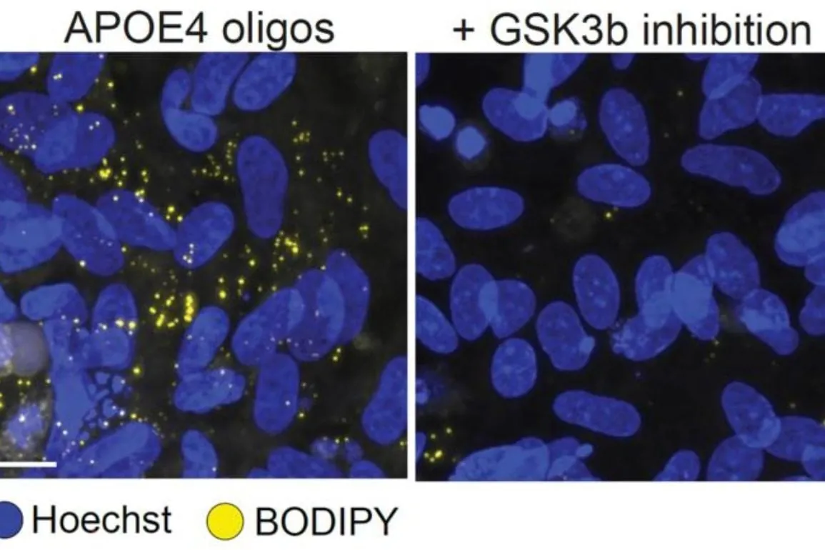 Boosting Wnt Signaling Reverses APOE4 Alzheimer’s Damage