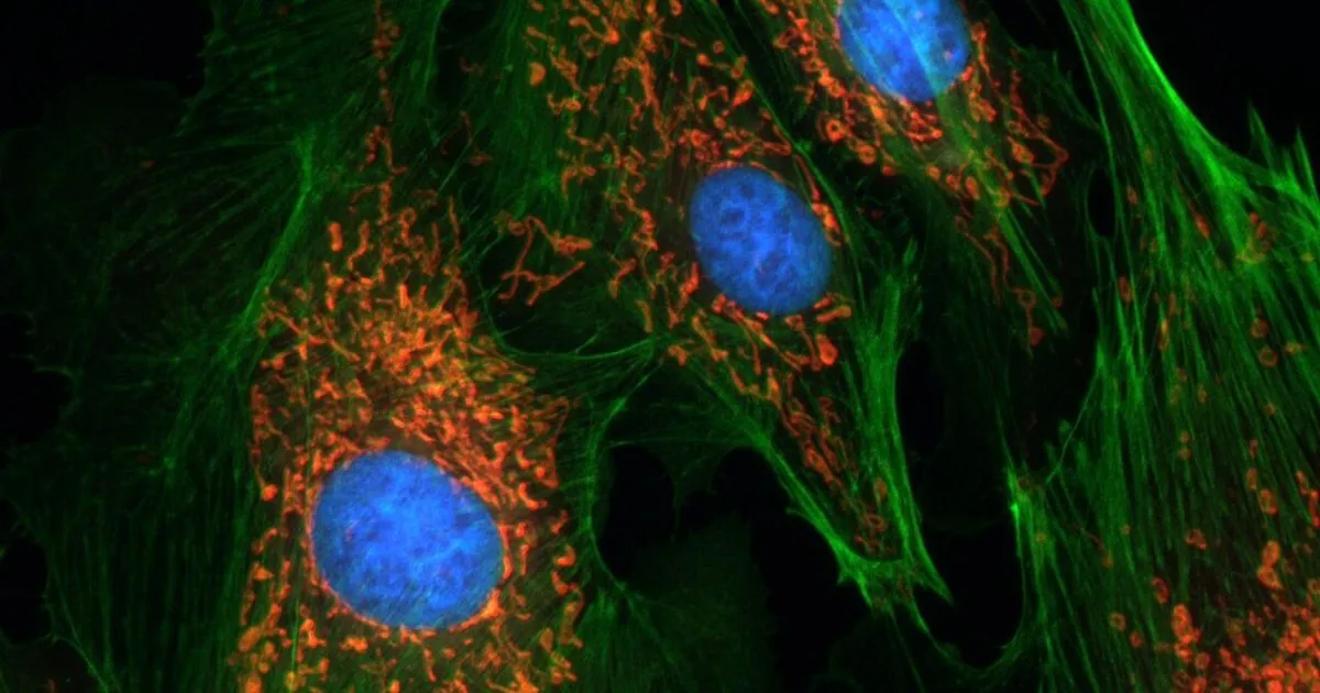 Aging as the slow loss of cell identity
