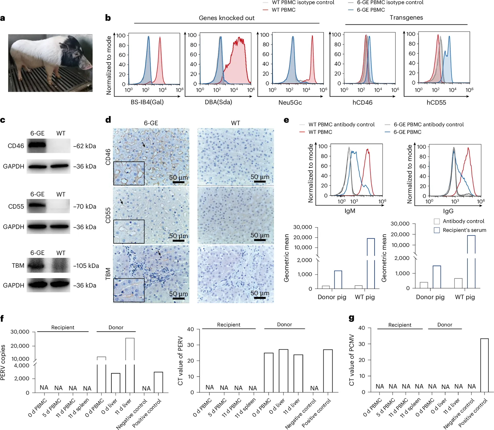 Orthotopic liver xenotransplantation from gene-modified pig to decedent human