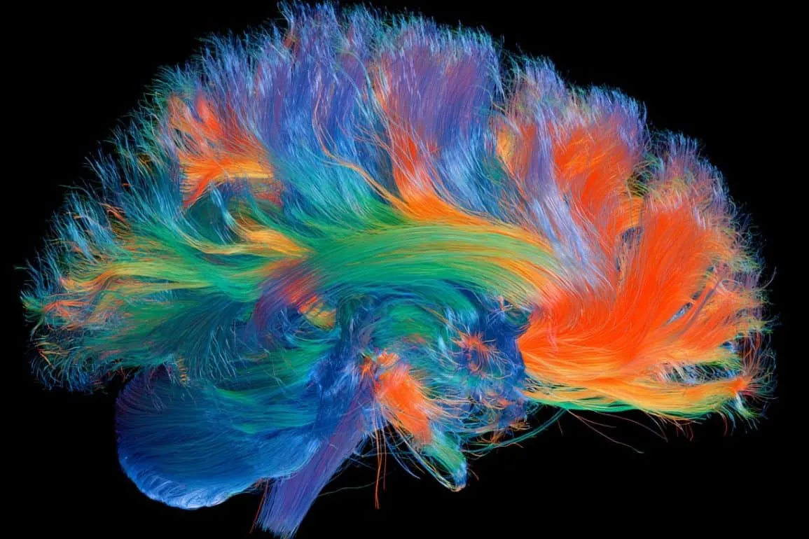 Brain Wiring Changes Distinguish Early Alzheimer’s from Normal Aging