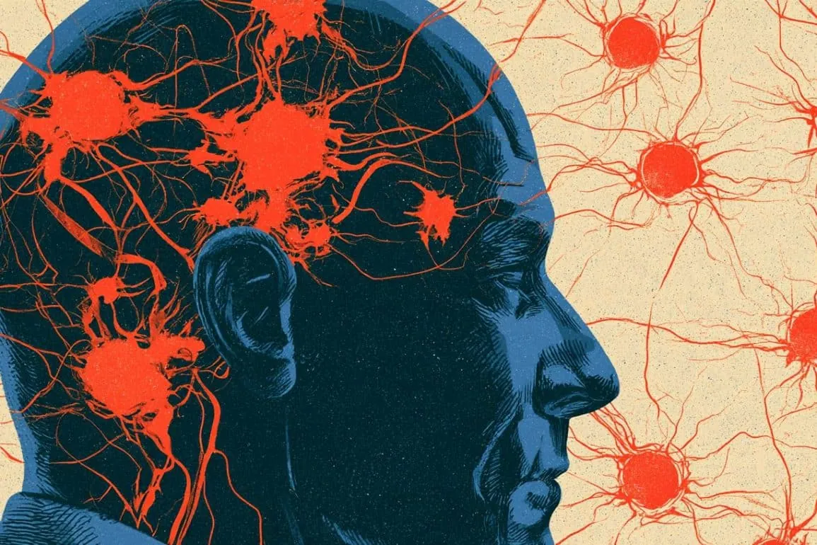 Overlooked Blood Cell May Tracks Parkinson’s Brain Changes