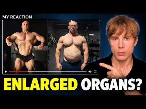 Dr Mike Israetel's Visceral Fat Scan Is Not Normal