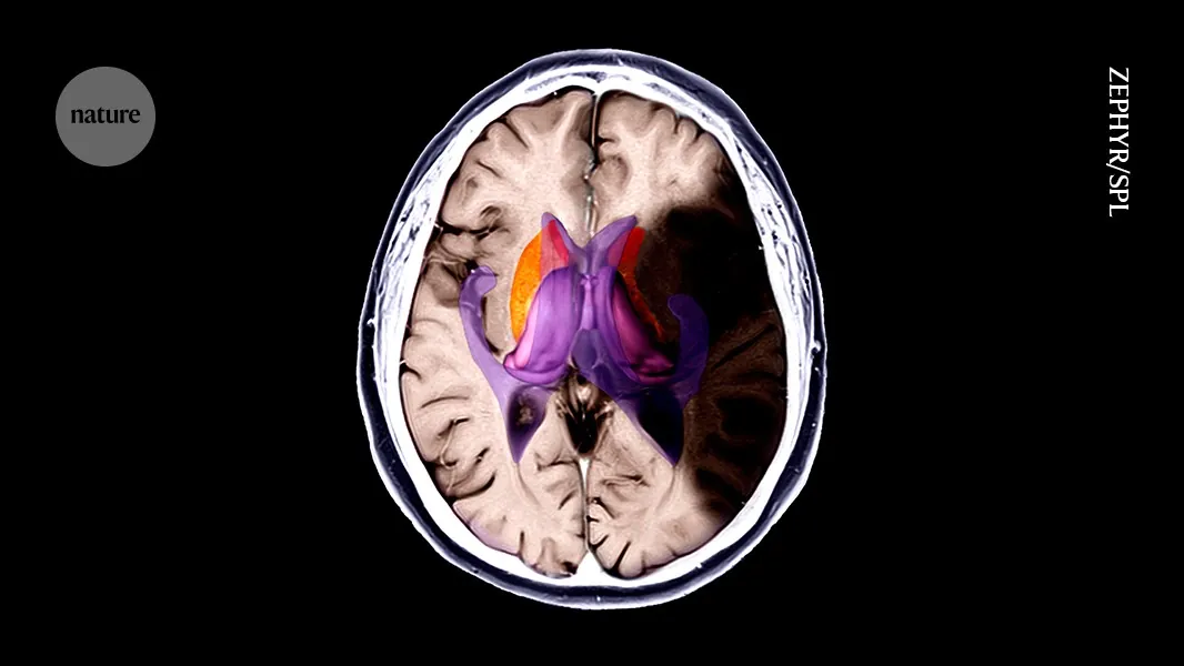 Freezing brain damage in its tracks: cooling drugs limit stroke injury in mice