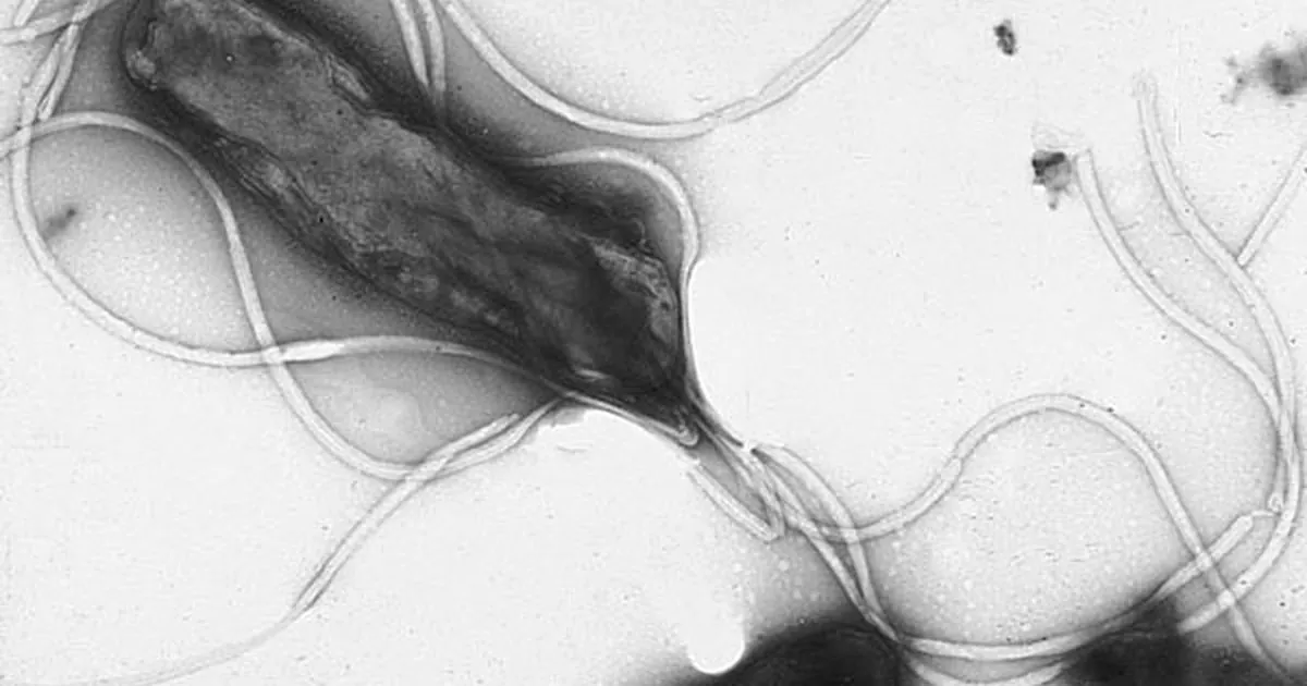 One in eight cancers worldwide starts with an infection