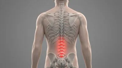 An Anti-Senescence Gene May Fight Spinal Disc Deterioration